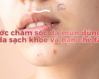 7 bước chăm sóc da mụn đúng cách giúp da sạch khỏe và hạn chế tái phát