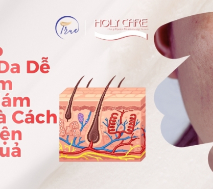 3 Lý Do Khiến Da Dễ Bị Thâm Mụn, Nám Sạm Và Cách Cải Thiện Hiệu Quả